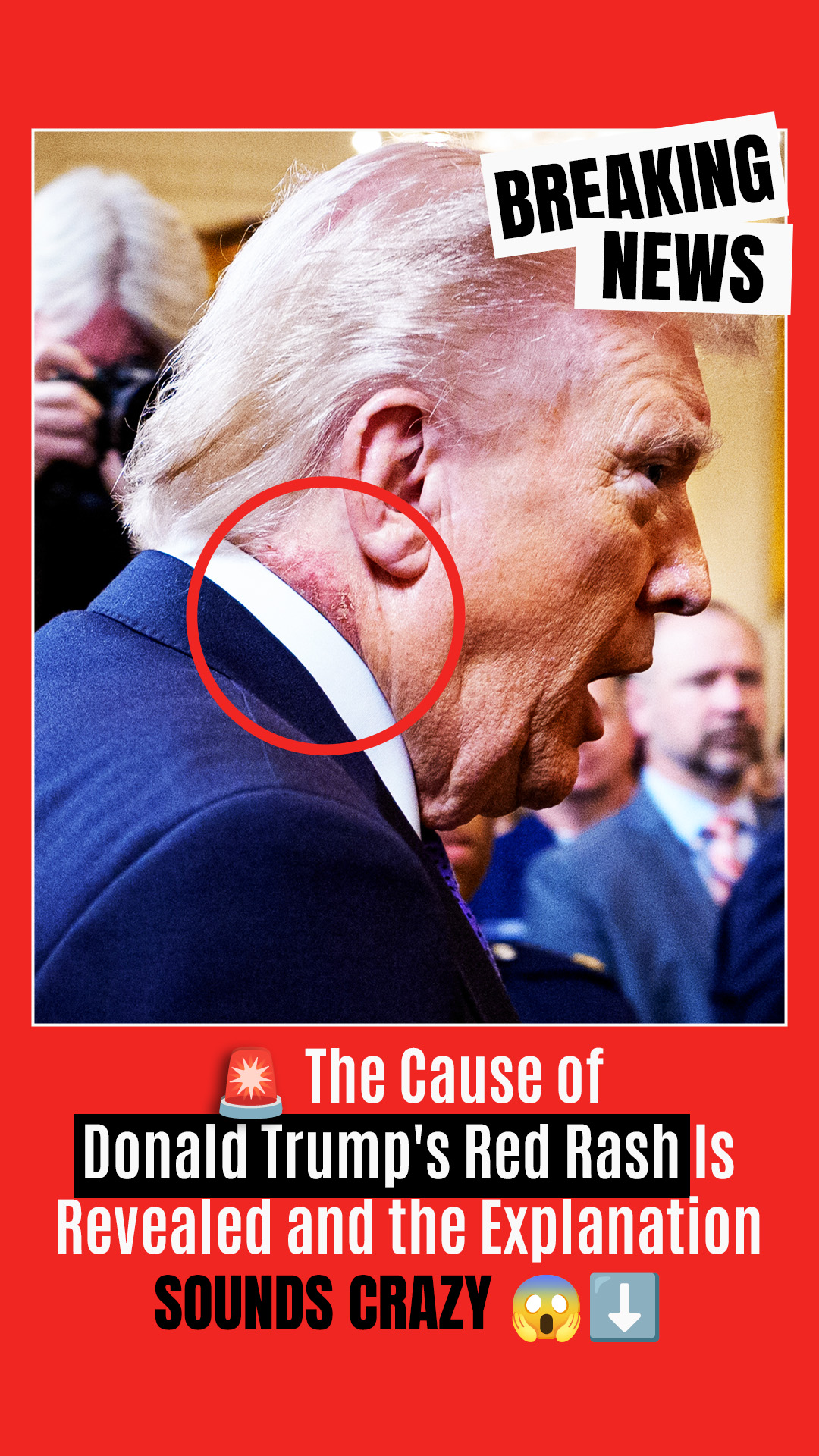 Red Rashes On Neck What's Behind the Rash on Donald Trump's Neck – His Doctor Breaks ...